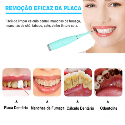 Limpador dental Ultrassônico